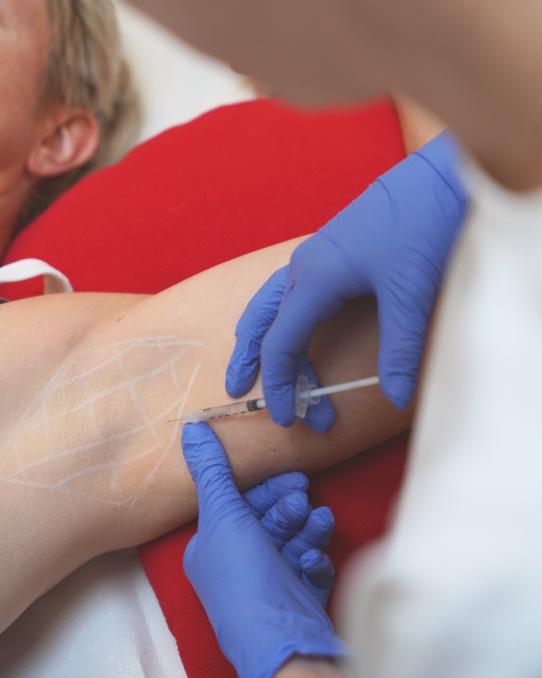 5 toepassingen van spierontspanners die je misschien nog niet kent